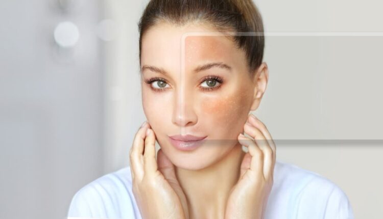 Rotina noturna para quem quer clarear manchas e uniformizar o tom da pele - nutralfit